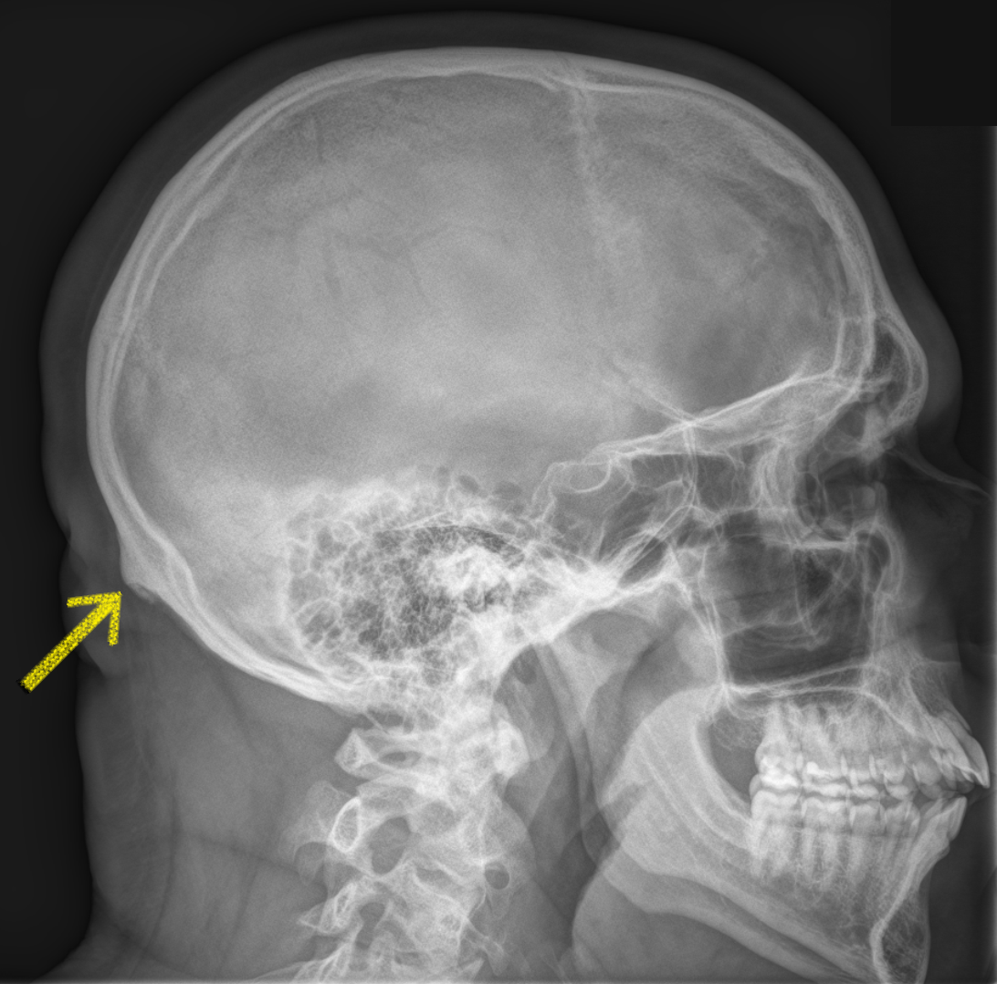 Concoustaion by Andrew Lombardi - Ourboox.com