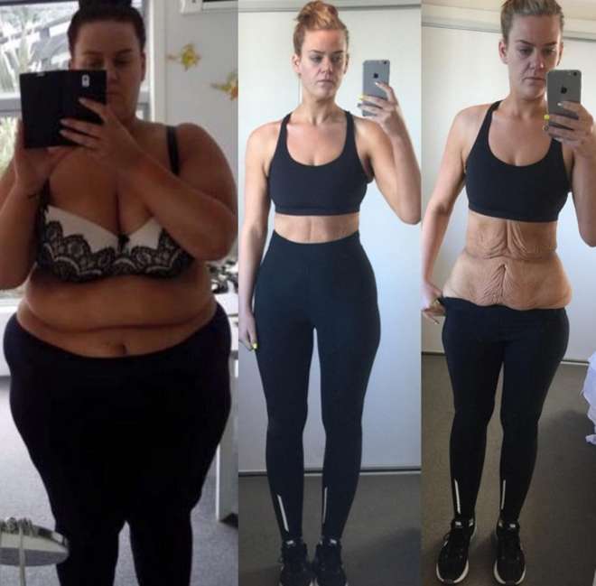 l’ OBESITA’ by sofia - Illustrated by Sofia Dell