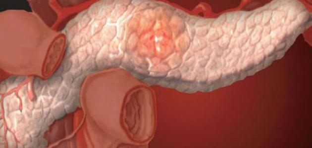 البنكرياس by nadya nadya - Illustrated by ناديا جبارين - Ourboox.com