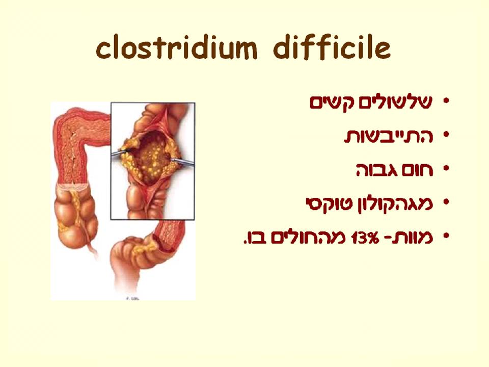 זיהומים נרכשים ודרכי מניעתם by murad jumhor - Illustrated by murad jumhor - Ourboox.com