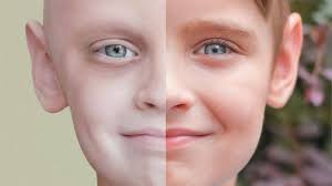 مرض السرطان by rawan - Illustrated by خليل السكاكيني - Ourboox.com