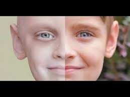 مرضى السرطان by raneen sider - Ourboox.com