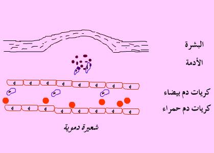 التعفن الجرثومي by rawand abdewahd - Ourboox.com