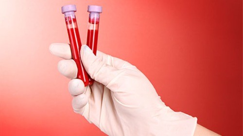 الدم by yasmine  - Illustrated by ياسمين بن عمر - Ourboox.com