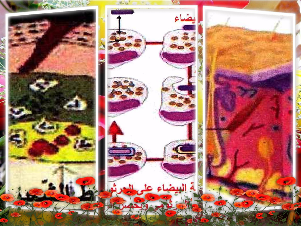 التعفن الجرثومي by rawand abdewahd - Ourboox.com