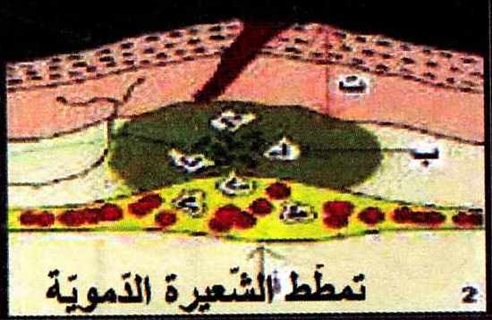 التعفن الجرثومي by malek - Illustrated by التعفن الجرثومي - Ourboox.com