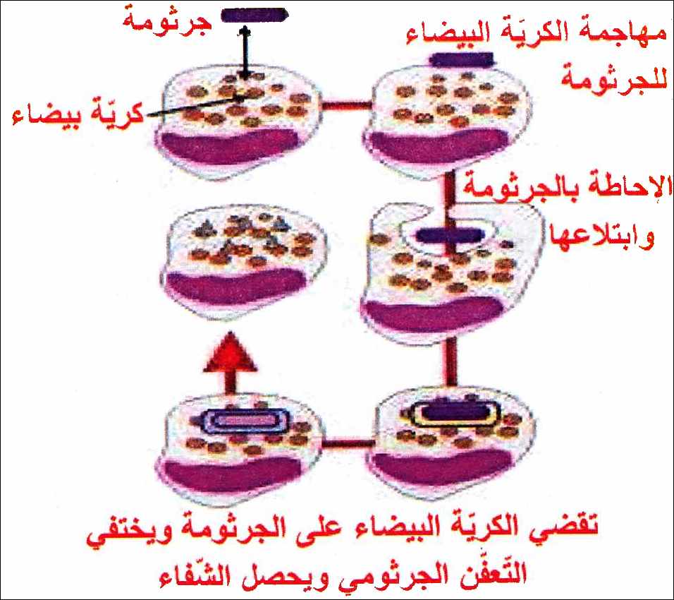التعفن الجرثومي و الوقاية منها by malek - Ourboox.com