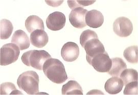 الدم by houssem - Ourboox.com