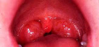 الدم by ademelir - Ourboox.com