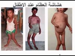 fatma marzouki by fatma marzouki - Ourboox.com