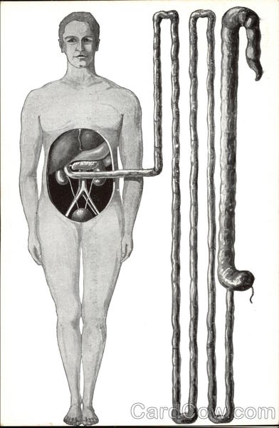 המעי הדק- רכבת ההרים של המזון by Anat - Ourboox.com