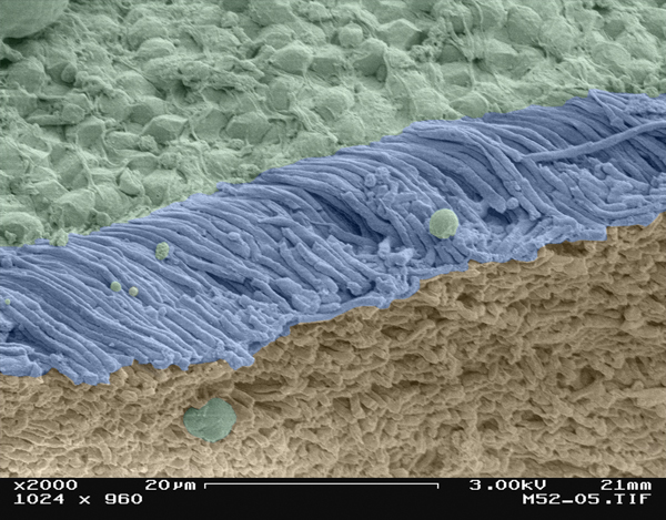 תאי עצב בעין by YUVAL KAPPEL - Illustrated by יובל קפל - Ourboox.com