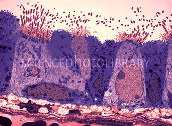 מאתרו של דניס קונקל