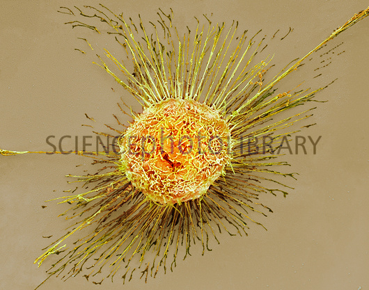 תא אפיתל של ריאה