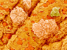 התמונה לקוחה מהאתר של דניס קונקל