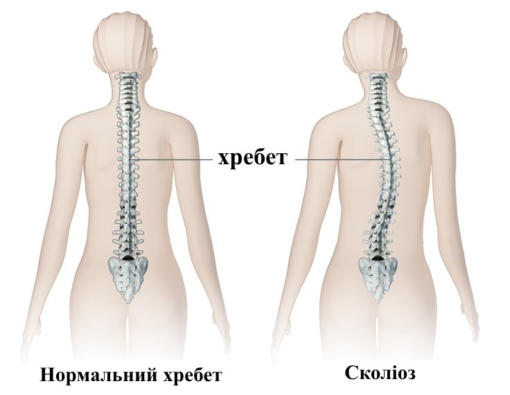 негативний вплив комп’ютера на здоров’я людини by Maxym - Ourboox.com