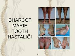 Nadir Hastalıklar by One Million Blue Ribbons - Ourboox.com