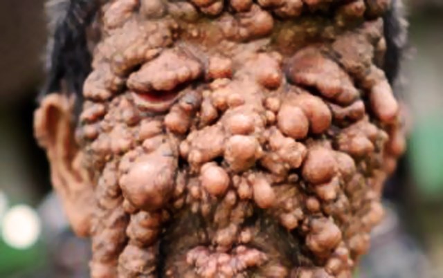 Nadir Hastalıklar by One Million Blue Ribbons - Ourboox.com