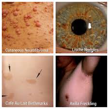 Nadir Hastalıklar by One Million Blue Ribbons - Ourboox.com