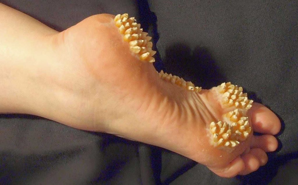 Nadir Hastalıklar by One Million Blue Ribbons - Ourboox.com