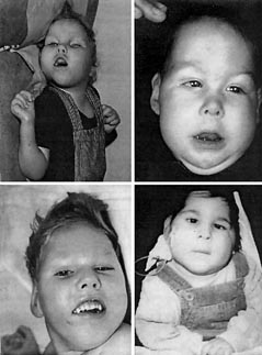 Nadir Hastalıklar by One Million Blue Ribbons - Ourboox.com