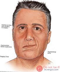 Nadir Hastalıklar by One Million Blue Ribbons - Ourboox.com