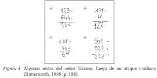 العسر الحسابي – ديسكلكوليا – Dyscalculia by sheren - Ourboox.com