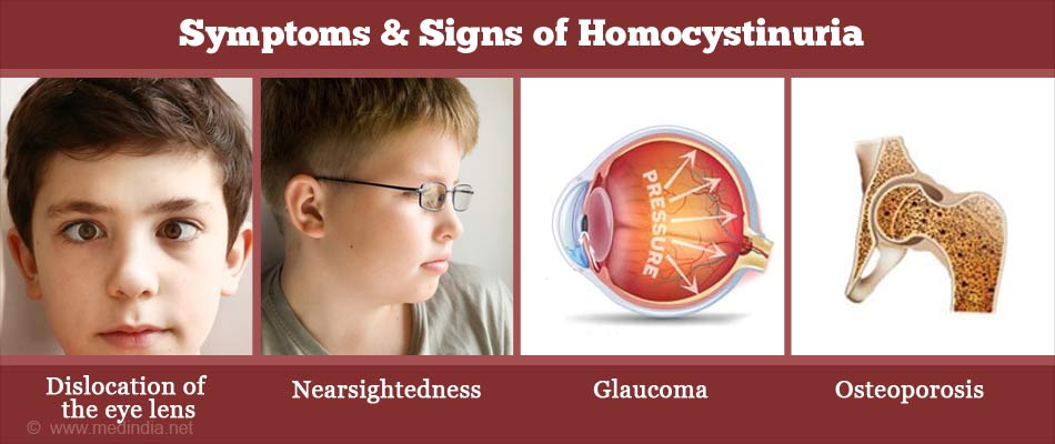 One million blue ribbons-Shejnaze Juka school-Shkoder-Albania by Etleva renci - Illustrated by Etleva Prenci - Ourboox.com