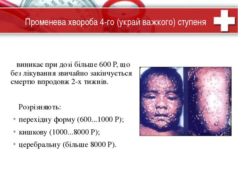 Радіація та її наслідки by Tatyana - Ourboox.com