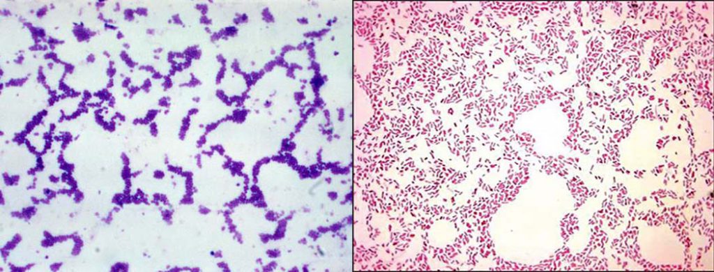 Bakteriler Alemi by Zeynep eker - Ourboox.com