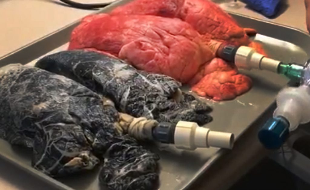 עישון by talya akoka - Illustrated by טליה אקוקה - Ourboox.com