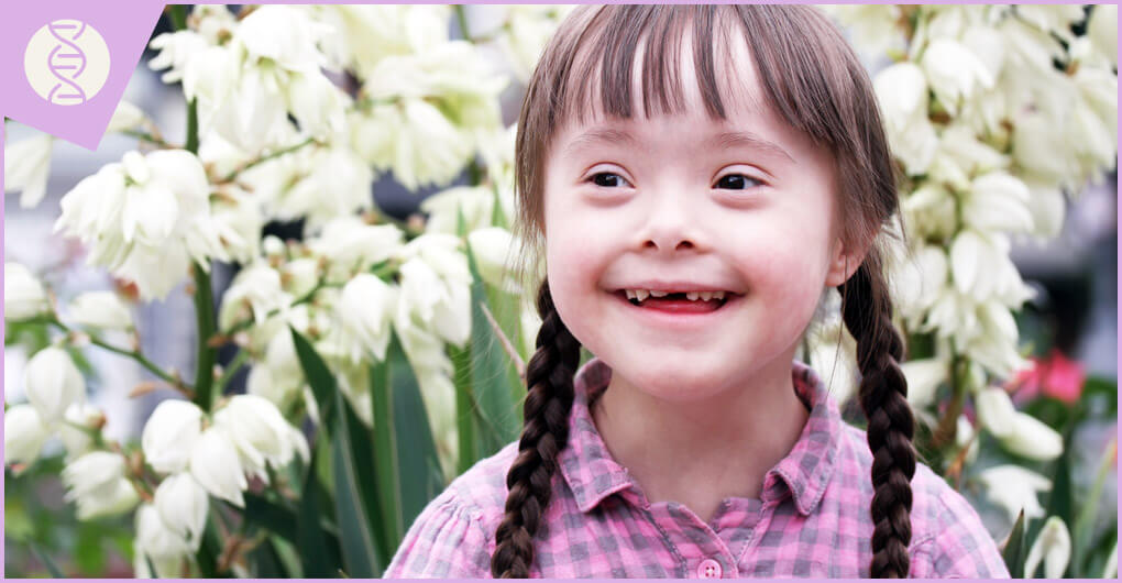 פיתוח מוטורי ודפוסי נוירו פסיכולוגיים באנשים עם תסמונת דאון by rimah - Illustrated by רמאח &  ג'יהאן - Ourboox.com