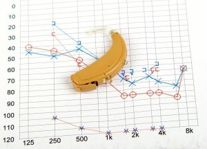 בדיקות שמיעה by musa abu ajaj - Illustrated by מוסא אבו עגאג  - Ourboox.com
