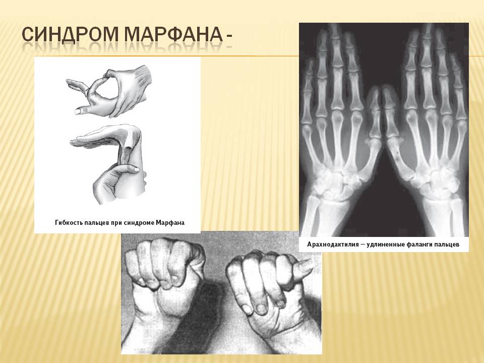Взаємодія генів.9кл. by Pidgorodetska Olena - Ourboox.com