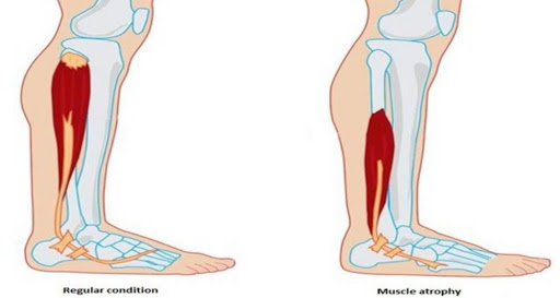 الأمراض الوراثية by Sham Hosary - Illustrated by شام حصري - Ourboox.com