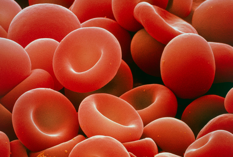 الأمراض الوراثية by Sham Hosary - Illustrated by شام حصري - Ourboox.com