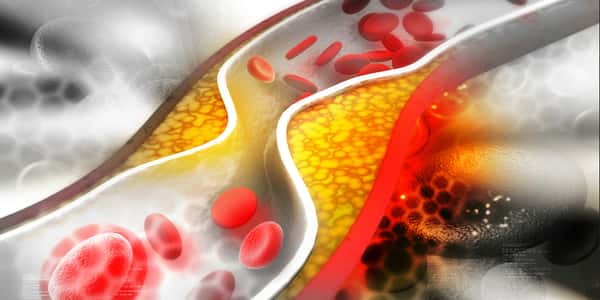 الكولسترول الضار وأمراض القلب by lamar - Ourboox.com