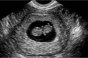 Мій щасливий лист by Roman - Ourboox.com