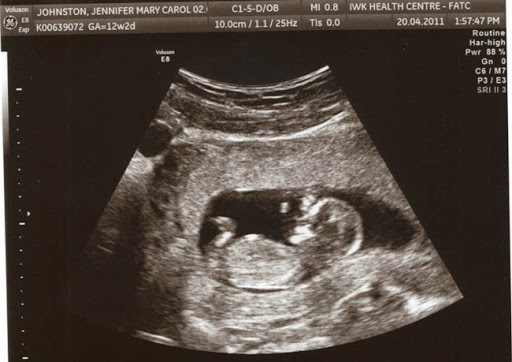 Мій щасливий лист by Roman - Ourboox.com