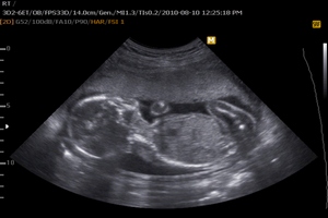 Мій щасливий лист by Roman - Ourboox.com