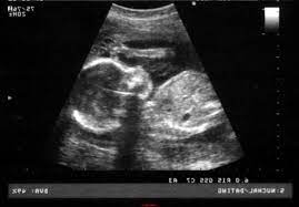 Мій щасливий лист by Roman - Ourboox.com