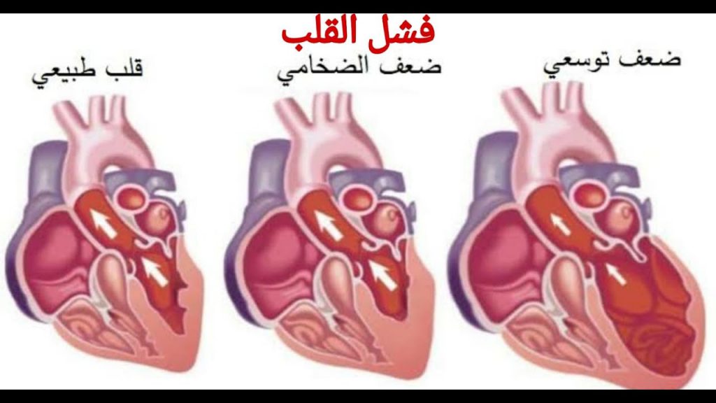 امراض القلب و الاوعية الدموية by Omar Alian - Ourboox.com
