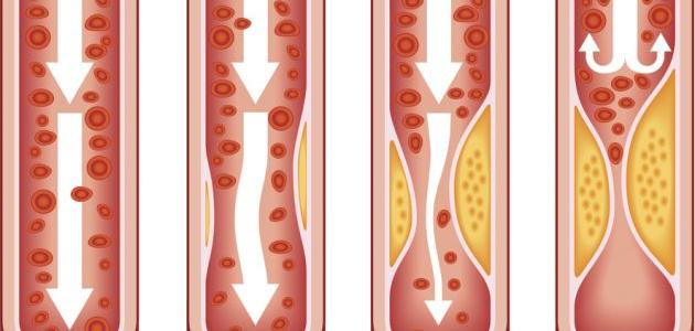 امراض القلب و الاوعية الدموية by Omar Alian - Ourboox.com