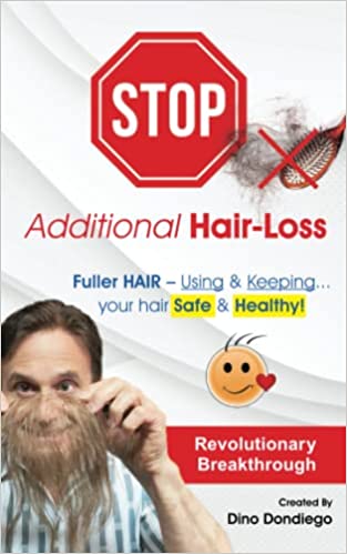 Stop Additional Hair Loss: Fuller Hair: Using and Keeping Your Hair Safe and Healthy Paperback – May 20, 2022 by Dino Dondiego - Ourboox.com