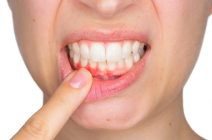 ProDentim Reviews – Is It Right For You? What to Know Before Buy! by ProDentim Reviews - Ourboox.com