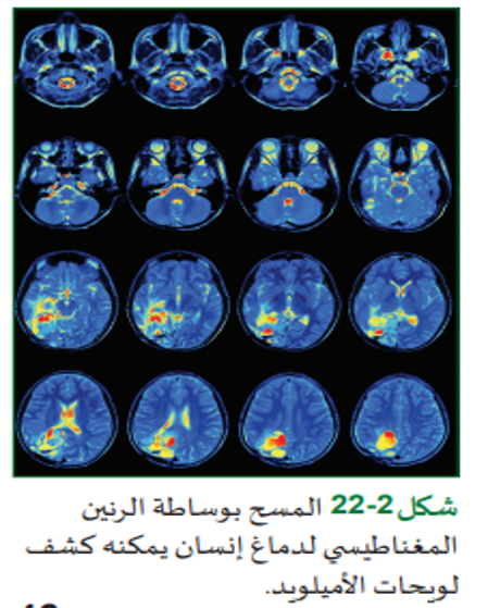 السائل النسيجي في الدماغ by roro - Illustrated by حنان حسين - Ourboox.com