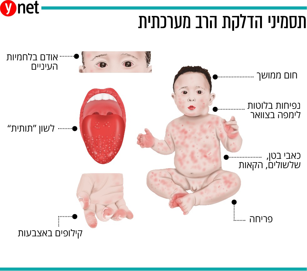 קורונה by Abeee khateeb - Ourboox.com