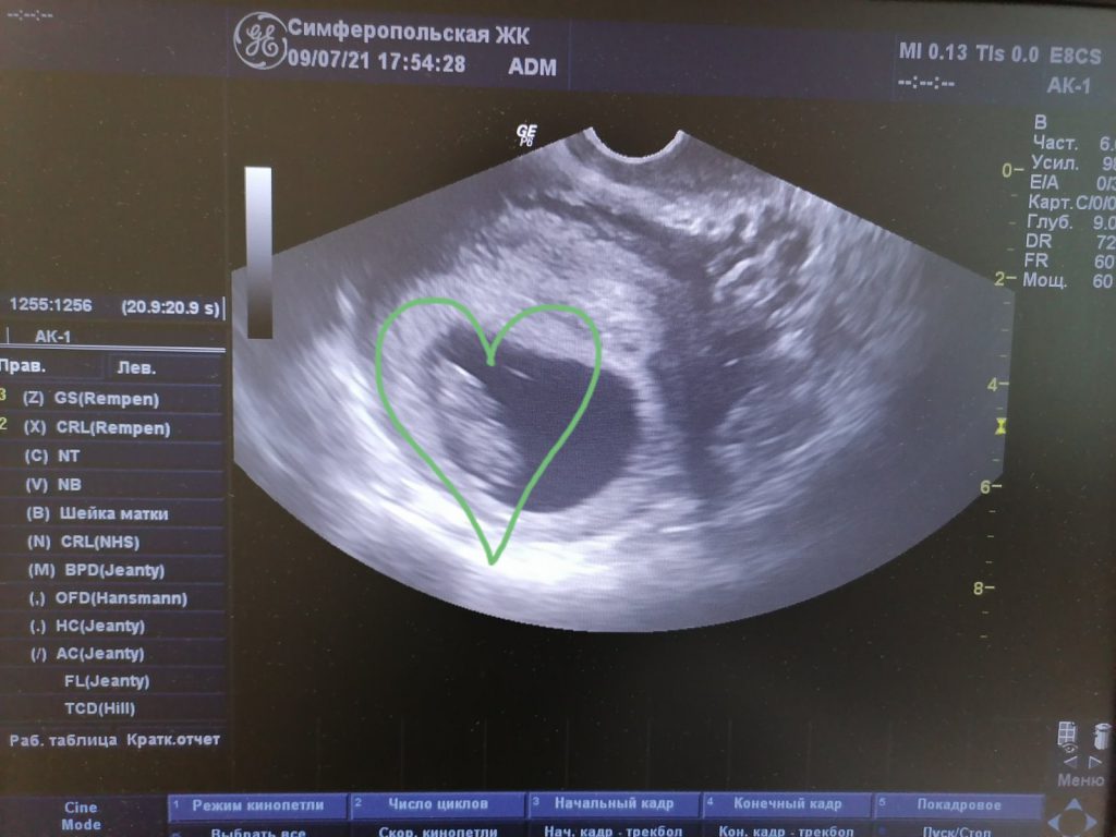 Мой первый год by Helena - Ourboox.com