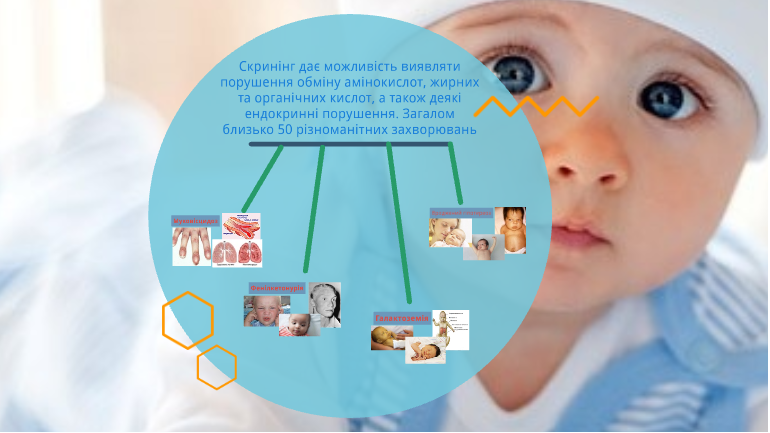 Скринінг-програми для новонароджених. by Olga - Ourboox.com