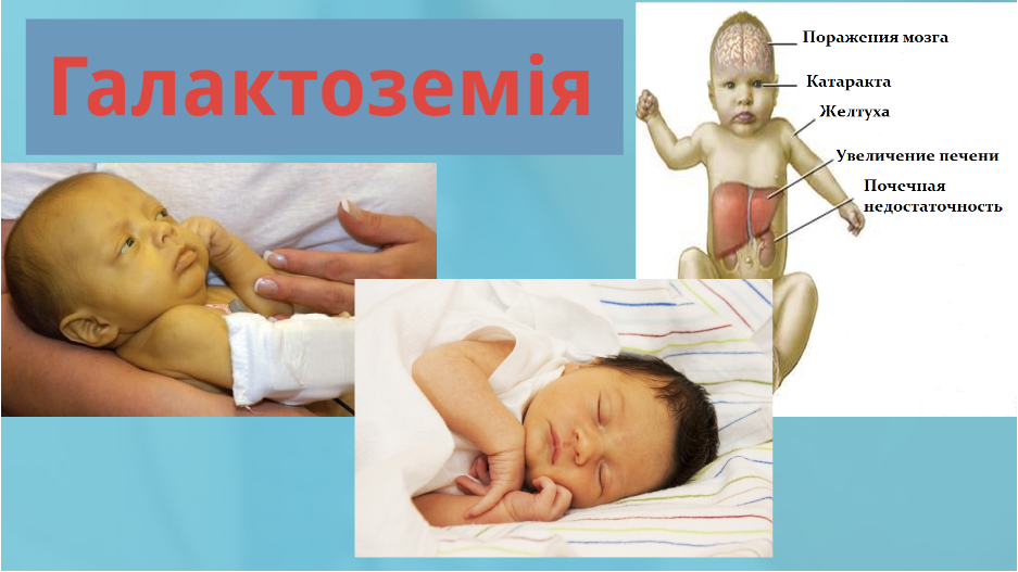 Скринінг-програми для новонароджених. by Olga - Ourboox.com